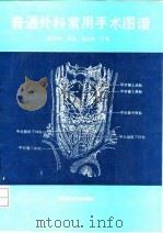 普通外科常用手术图谱 1993 PDF电子版封面 7502319441 张作峰等主编