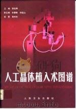 人工晶体植入术图谱（1998 PDF版）