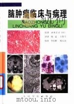 脑肿瘤临床与病理（1998 PDF版）
