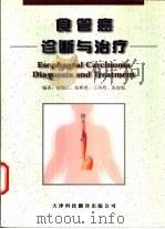 食管癌诊断与治疗 1999 PDF电子版封面 7543311550 赵锡江等编著
