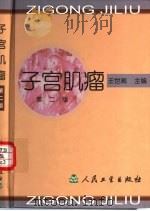 子宫肌瘤  第2版（1987 PDF版）