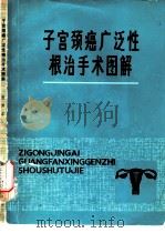 子宫颈癌广泛性根治手术图解（1980 PDF版）