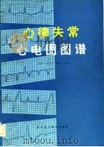 心律失常心电图图谱（1982 PDF版）