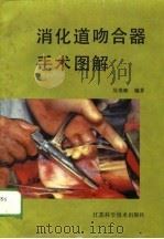 消化道吻合器手术图解（1989 PDF版）