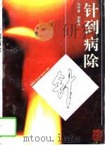 针到病除（1994 PDF版）