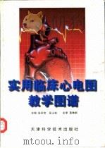 实用临床心电图教学图谱（1999 PDF版）