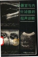 小器官与内分泌腺的超声诊断 1995 PDF电子版封面 7204009657 张缙熙,苏占福主编