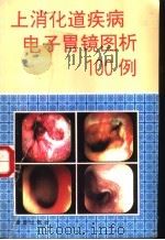 上消化道疾病电子胃镜图析100例 1994 PDF电子版封面 7800229319 梁浩主编;丁秀婷,刘凡,陈玲玲等编