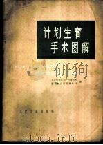 计划生育手术图解 1965 PDF电子版封面 重庆医学院妇产科教研室,重庆医学院泌尿外科编