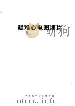 疑难心电图读片（ PDF版）