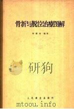 骨折与脱位治疗图解 1958 PDF电子版封面 14048·1411 刘润田编著