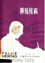 肺结核病 1983 PDF电子版封面 14200·47 许学受编著