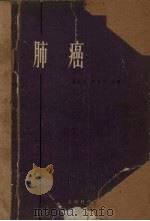 肺癌 1962 PDF电子版封面 14119·1042 徐昌文,吴善芳编