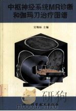 中枢神经系统MR诊断和伽玛刀治疗图谱 1998 PDF电子版封面 7536437919 吴锡标编