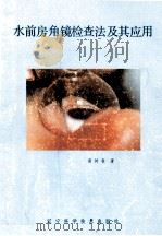 水前房角镜检查法及其应用 1987 PDF电子版封面 14288·136 黄树春编