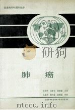 肺癌 第1卷 1990 PDF电子版封面 7538405690 赵洪序等主译