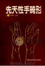先天性手畸形 1989 PDF电子版封面 王承武主译