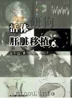 活体肝脏移植（ PDF版）