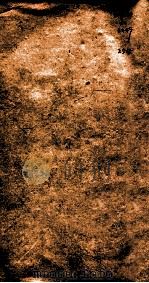 杂病证治类方  第1册（1793 PDF版）