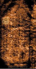 杂病证治类方  第5册  下（1793 PDF版）
