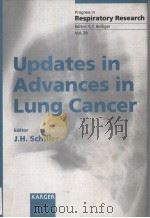 RPOGRESS IN RESPIRATORY RESEARCH VOL.29 UPDATES IN ADVANCES IN LUNG CANCER PDF电子版封面 3805565577 J.H.SCHILLER