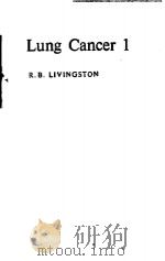 LUNG CANCER 1 PDF电子版封面 R.B.LIVINGSTON