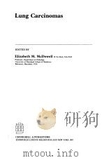 LUNG CARCINOMAS 1987 PDF电子版封面 0443031657