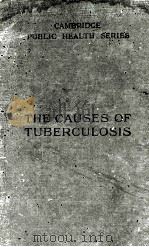 the causes of tuberculosis P707（ PDF版）