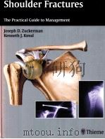 Shoulder Fractures  The Practical Guide to Management     PDF电子版封面  1588903109  Joseph D.Zuckerman  Kenneth J. 