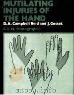 MUTILATING INJURIES OF THE HAND PDF电子版封面 0443016844 D.A.Campbell Reid