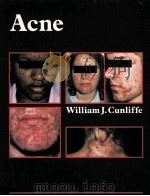 ACNE 1989 PDF电子版封面 0815120753