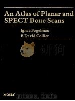 AN ATLAS OF PLANAR AND SPECT BONE SCANS 1989 PDF电子版封面 080163296X