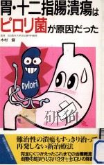 胃·十二指腸潰瘍はピロリ菌が原因だった（1995.11 PDF版）