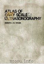ATLAS OF GRAY SCALE ULTRASONSGRAPHY 1978 PDF电子版封面 0443080011