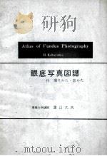 眼底写真图谱 付 撮クかた·诊かた atlas of fundus photography（ PDF版）