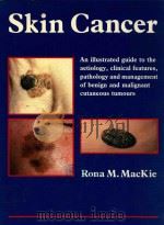 SKIN CANCER（1989 PDF版）